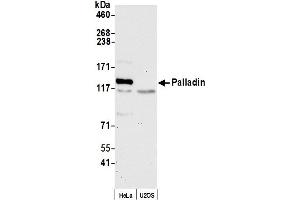 anti-Palladin, Cytoskeletal Associated Protein (PALLD) (AA 75-125) antibody