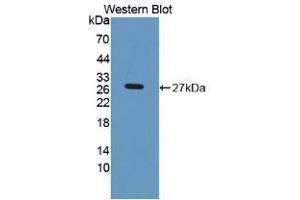 Western blot analysis of recombinant Rat LPO. (LPO anticorps  (AA 351-589))