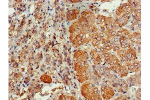 Immunohistochemistry of paraffin-embedded human adrenal gland tissue using ABIN7147287 at dilution of 1:100