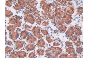 IHC-P analysis of Human Stomach tissue, with DAB staining. (CDCP1 anticorps  (AA 689-836))
