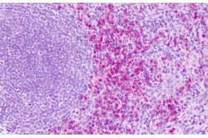 Anti-S1PR4 / EDG6 antibody IHC staining of human spleen. (S1PR4 anticorps  (Cytoplasmic Domain))