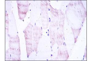 Immunohistochemistry (IHC) image for anti-Oligodendrocyte Lineage Transcription Factor 2 (OLIG2) antibody (ABIN1845900)