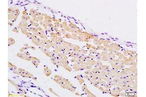 Formalin-fixed and paraffin embedded rat heart tissue labeled with Anti-PER2/Period circadian protein 2 Polyclonal Antibody, Unconjugated  at 1:200 followed by conjugation to the secondary antibody and DAB staining
