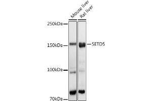 Western blot analysis of extracts of various cell lines, using SETD5 antibody (ABIN6132960, ABIN6147644, ABIN6147646 and ABIN6223140) at 1:1000 dilution. (SETD5 anticorps  (AA 520-740))