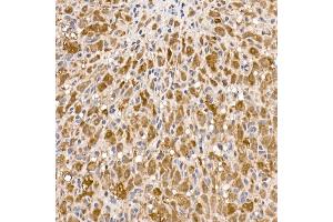 Immunohistochemistry of paraffin-embedded rat ovary using ACLY Rabbit pAb (ABIN7265716) at dilution of 1:150 (40x lens).