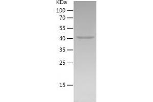 Western Blotting (WB) image for NLR Family, Pyrin Domain Containing 3 (NLRP3) (AA 5-218) protein (His-IF2DI Tag) (ABIN7124184)