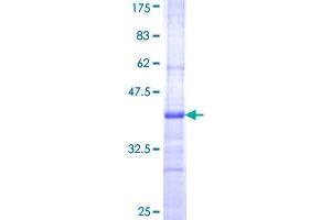 Image no. 1 for Cartilage Intermediate Layer Protein, Nucleotide Pyrophosphohydrolase (CILP) (AA 129-226) protein (GST tag) (ABIN1349485)