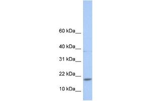 WB Suggested Anti-MAX Antibody Titration:  0. (MAX anticorps  (N-Term))