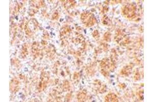 Immunohistochemistry of DARC in mouse brain tissue with DARC polyclonal antibody  at 2. (DARC anticorps  (C-Term))