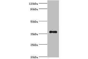Western blot All lanes: AKR1B10 antibody at 4 μg/mL + A549 whole cell lysate Secondary Goat polyclonal to rabbit IgG at 1/10000 dilution Predicted band size: 36 kDa Observed band size: 36 kDa
