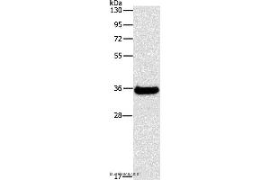Western blot analysis of Human fetal liver tissue, using FGL1 Polyclonal Antibody at dilution of 1:500 (FGL1 anticorps)