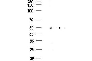 Western blot analysis of lysates from Rat testis, using HARS Antibody at 1/1000 dilution.