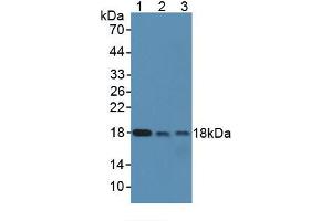 Rabbit Capture antibody from the kit in WB with Positive Control: Lane 1: Mouse serum, Lane 2: Mouse liver, Lane 3: Mouse uterus, Lane 4: Mouse bladder, Lane 5: Mouse ovary. (SOD1 Kit ELISA)