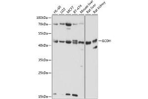 Western blot analysis of extracts of various cell lines, using GCDH antibody (ABIN6132101, ABIN6141009, ABIN6141010 and ABIN6224875) at 1:1000 dilution. (GCDH anticorps  (AA 149-438))