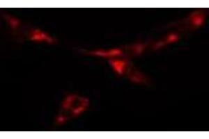 ABIN6277886 staining  NIH-3T3 cells by IF/ICC. (PKD2 anticorps  (N-Term))