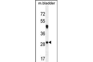 NCALD Antibody (C-term) (ABIN654452 and ABIN2844186) western blot analysis in mouse bladder tissue lysates (35 μg/lane). (NCALD anticorps  (C-Term))