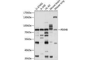 Western blot analysis of extracts of various cell lines, using PDE4B antibody (ABIN6132469, ABIN6145350, ABIN6145351 and ABIN6214353) at 1:1000 dilution. (PDE4B anticorps  (AA 1-130))