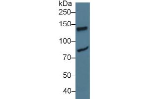 Western Blot; Sample: Human Jurkat cell lysate; Primary Ab: 3µg/ml Rabbit Anti-Rat LIG1 Antibody Second Ab: 0. (LIG1 anticorps  (AA 568-875))