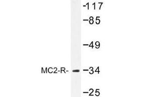Image no. 1 for anti-Melanocortin 2 Receptor (Adrenocorticotropic Hormone) (MC2R) antibody (ABIN317741) (MC2R anticorps)