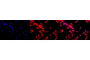 Immunocytochemistry/Immunofluorescence analysis using Rat Anti-HSF1 Monoclonal Antibody, Clone 10H8 (ABIN361703 and ABIN361704). (HSF1 anticorps  (AA 378-395))