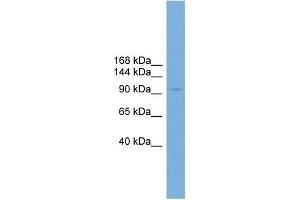 Human HT1080; WB Suggested Anti-PIWIL4 Antibody Titration: 0. (PIWIL4 anticorps  (N-Term))
