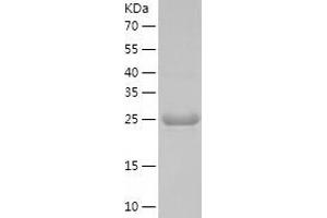 Western Blotting (WB) image for Ubiquitin-Conjugating Enzyme E2, J1, U (UBE2J1) (AA 1-282) protein (His-IF2DI Tag) (ABIN7125604)