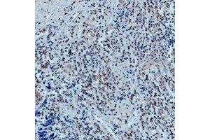 Immunohistochemical analysis of 42278 staining in human tonsil formalin fixed paraffin embedded tissue section. (POU2F1 anticorps)