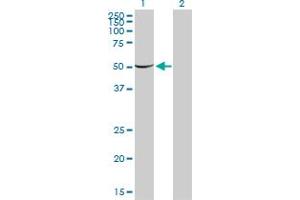 Western Blot analysis of PGM1 expression in transfected 293T cell line by PGM1 monoclonal antibody (M01), clone 3B8-H4. (Phosphoglucomutase 1 anticorps  (AA 1-562))