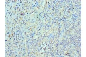 Immunohistochemistry of paraffin-embedded human epityphlon tissue using ABIN7172544 at dilution of 1:100 (ETV6 anticorps  (AA 1-300))