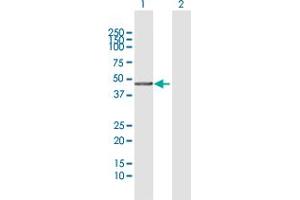 Western Blot analysis of DNMT3L expression in transfected 293T cell line by DNMT3L MaxPab polyclonal antibody.