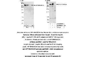 Image no. 1 for anti-Spectrin, Beta, Non-erythrocytic 2 (SPTBN2) (AA 2300-2390), (C-Term) antibody (ABIN363600)