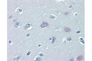 Immunohistochemistry (IHC) image for anti-Transient Receptor Potential Cation Channel, Subfamily M, Member 2 (TRPM2) (N-Term) antibody (ABIN2781840) (TRPM2 anticorps  (N-Term))
