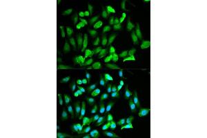Immunofluorescence analysis of HeLa cells using ERG antibody.