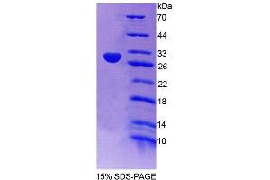 SDS-PAGE analysis of Human NAIP Protein. (NAIP Protéine)