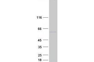 Validation with Western Blot