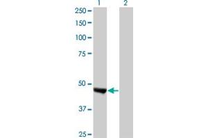 Western Blot analysis of KIAA0261 expression in transfected 293T cell line by KIAA0261 monoclonal antibody (M02), clone 2B3.