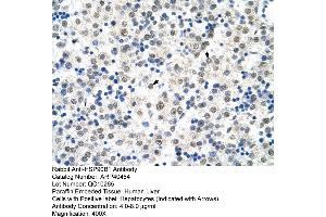 Rabbit Anti-HSP90B1 Antibody  Paraffin Embedded Tissue: Human Liver Cellular Data: Hepatocytes Antibody Concentration: 4. (GRP94 anticorps  (N-Term))