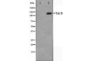 Western blot analysis of Trk B expression in HepG2 whole cell lysates,The lane on the left is treated with the antigen-specific peptide. (TRKB anticorps  (C-Term))