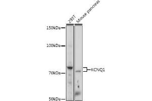 Western blot analysis of extracts of various cell lines, using KCNQ1 Rabbit pAb (ABIN3023120, ABIN3023121, ABIN3023122 and ABIN6219399) at 1:1000 dilution.