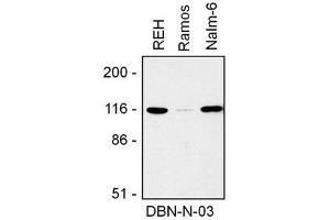 Image no. 1 for anti-Drebrin 1 (DBN1) (AA 1-326), (N-Term) antibody (ABIN1449383) (DBN1 anticorps  (N-Term))