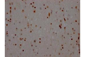 IHC image of ABIN7127643 diluted at 1:100 and staining in paraffin-embedded human brain tissue performed on a Leica BondTM system.