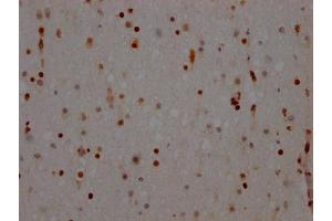 IHC image of ABIN7127643 diluted at 1:100 and staining in paraffin-embedded human brain tissue performed on a Leica BondTM system. (Recombinant NONO anticorps)