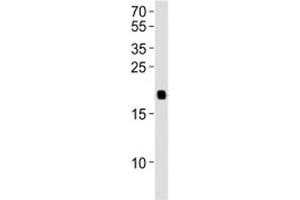 Western blot analysis of lysate from 293T cell line using HRAS antibody diluted at 1:1000.