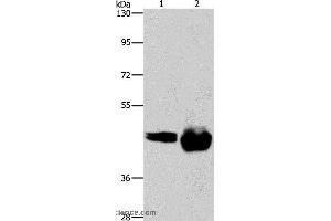 Western blot analysis of A549 and Raji cell, using CD38 Polyclonal Antibody at dilution of 1:520 (CD38 anticorps)