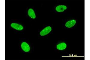anti-Ladybird Homeobox 2 (LBX2) (AA 95-194) antibody