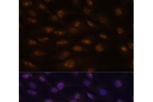 Immunofluorescence analysis of C6 cells using MYOD1 Polyclonal Antibody at dilution of 1:100. (MYOD1 anticorps)