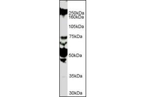 Antibody (1 µg/ml) staining of HUVEC lysate (35 µg protein in RIPA buffer). (ROBO1 anticorps  (Internal Region))