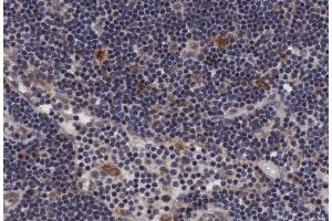 ABIN6267416 at 1/200 staining human lymph nodes tissue sections by IHC-P.