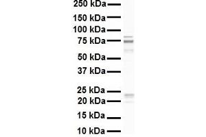 WB Suggested Anti-RHOT1 antibody Titration: 1 ug/mL Sample Type: Human A549