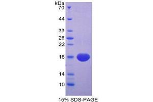SDS-PAGE (SDS) image for Syndecan 4 (SDC4) (AA 18-145) protein (His tag) (ABIN1981028) (SDC4 Protein (AA 18-145) (His tag))